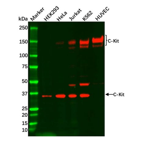 aladdin 阿拉丁 Ab096640 Recombinant c-Kit Antibody Recombinant (R08-1F9); Rabbit anti Human c-Kit Antibody; WB, IHC; Unconjugated