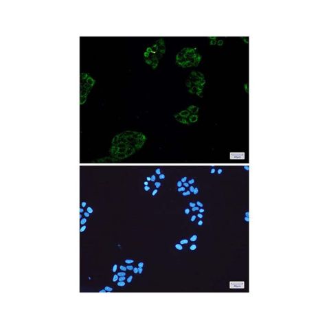 aladdin 阿拉丁 Ab097188 Recombinant Collagen III Antibody Recombinant (R06-4E1); Rabbit anti Human Collagen III Antibody; WB, ICC, IF; Unconjugated