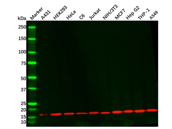aladdin 阿拉丁 Ab097410 Recombinant COX IV Antibody Recombinant (RR684); Rabbit anti Human COX IV Antibody; WB, IHC, Flow, IF, ICC, IP; Unconjugated