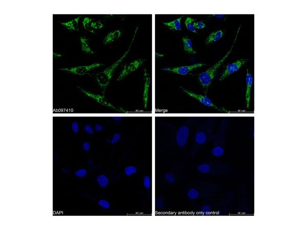 aladdin 阿拉丁 Ab097410 Recombinant COX IV Antibody Recombinant (RR684); Rabbit anti Human COX IV Antibody; WB, IHC, Flow, IF, ICC, IP; Unconjugated
