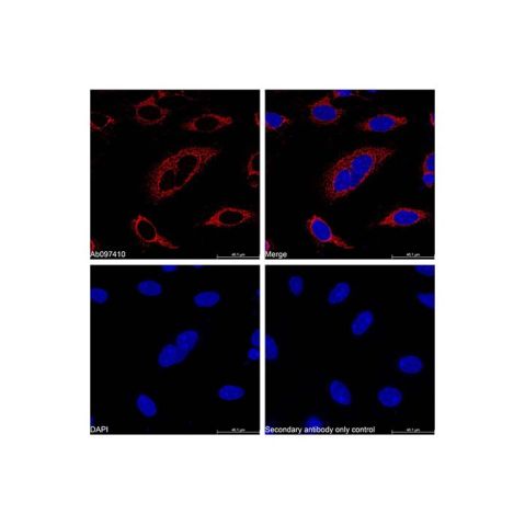 aladdin 阿拉丁 Ab097410 Recombinant COX IV Antibody Recombinant (RR684); Rabbit anti Human COX IV Antibody; WB, IHC, Flow, IF, ICC, IP; Unconjugated