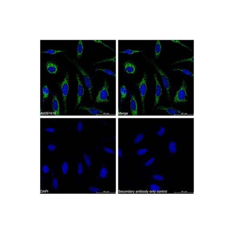 aladdin 阿拉丁 Ab097410 Recombinant COX IV Antibody Recombinant (RR684); Rabbit anti Human COX IV Antibody; WB, IHC, Flow, IF, ICC, IP; Unconjugated
