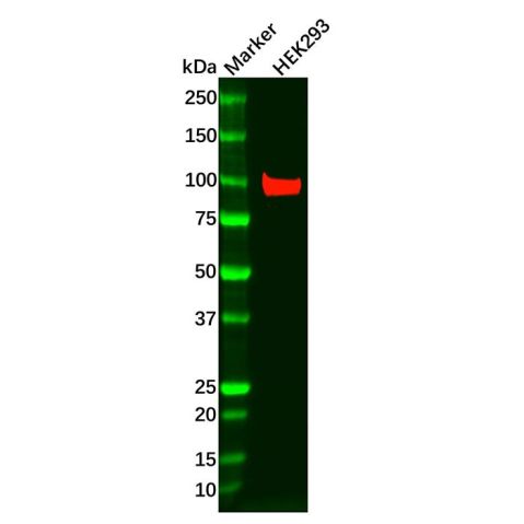 aladdin 阿拉丁 Ab098114 Recombinant CTNNA3 Antibody Recombinant (R09-4Y5); Rabbit anti Human CTNNA3 Antibody; WB; Unconjugated