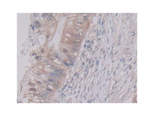 aladdin 阿拉丁 Ab098507 Cyclophilin A Mouse mAb mAb(C10); Mouse anti Human Cyclophilin A Antibody; WB, IHC, ICC, IF; Unconjugated