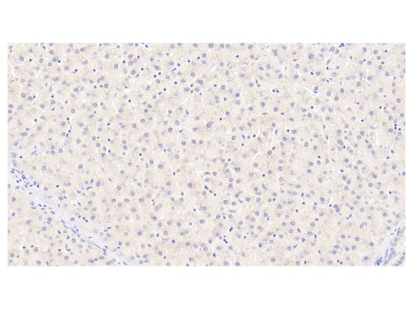 aladdin 阿拉丁 Ab098512 Cyclophilin B Mouse mAb mAb(C1); Mouse anti Human Cyclophilin B Antibody; WB, IHC; Unconjugated