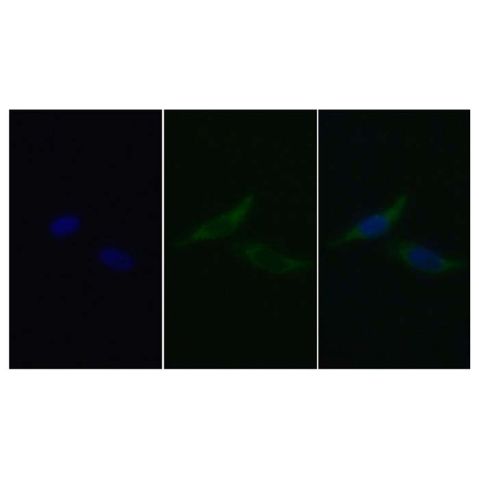 aladdin 阿拉丁 Ab098695 Cytochrome C Mouse mAb mAb (C2); Mouse anti Human Cytochrome C Antibody; WB, IHC, ICC, IF; Unconjugated