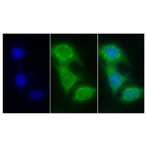 aladdin 阿拉丁 Ab098695 Cytochrome C Mouse mAb mAb (C2); Mouse anti Human Cytochrome C Antibody; WB, IHC, ICC, IF; Unconjugated
