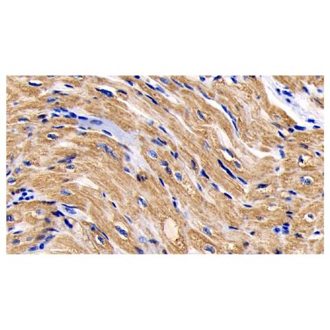 aladdin 阿拉丁 Ab098695 Cytochrome C Mouse mAb mAb (C2); Mouse anti Human Cytochrome C Antibody; WB, IHC, ICC, IF; Unconjugated