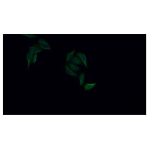 aladdin 阿拉丁 Ab099041 Cytokeratin 8 Antibody pAb; Rabbit anti Human Cytokeratin 8 Antibody; WB, IHC, ICC, IF; Unconjugated