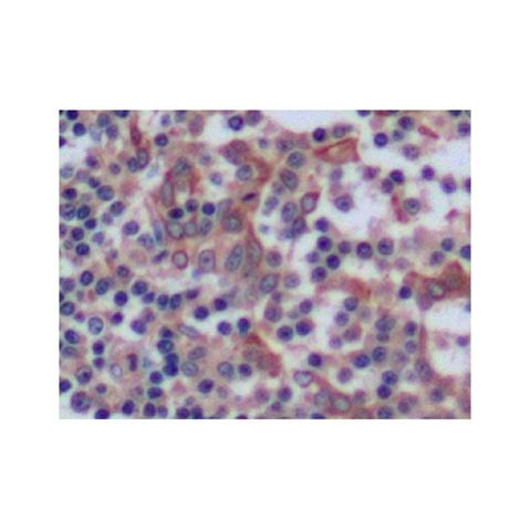 aladdin 阿拉丁 Ab099041 Cytokeratin 8 Antibody pAb; Rabbit anti Human Cytokeratin 8 Antibody; WB, IHC, ICC, IF; Unconjugated