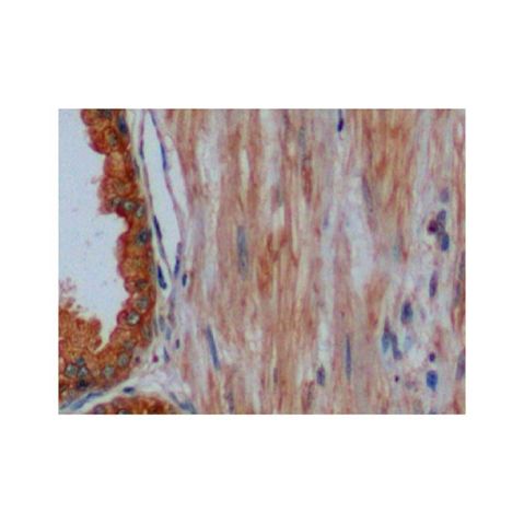 aladdin 阿拉丁 Ab099041 Cytokeratin 8 Antibody pAb; Rabbit anti Human Cytokeratin 8 Antibody; WB, IHC, ICC, IF; Unconjugated
