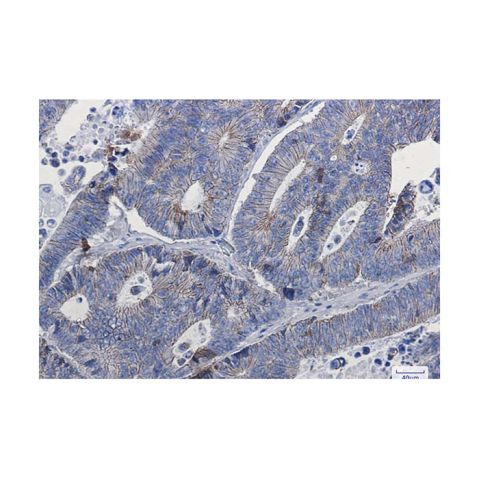 aladdin 阿拉丁 Ab099575 Recombinant delta 1 Catenin/CAS Antibody Recombinant (R01-4G3); Rabbit anti Human delta 1 Catenin/CAS Antibody; WB, IHC; Unconjugated