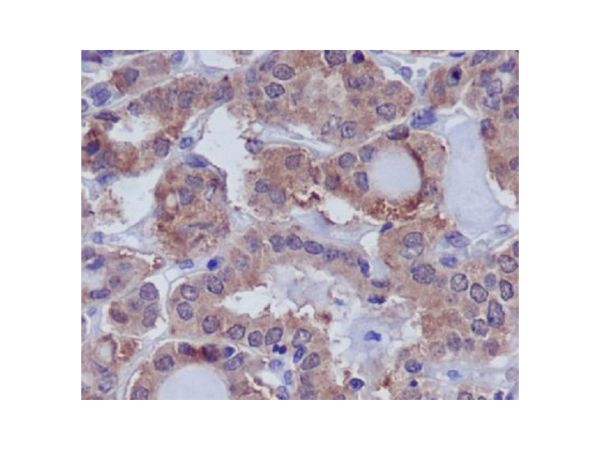 aladdin 阿拉丁 Ab100604 Recombinant DUSP6 Antibody Recombinant (R07-6C1); Rabbit anti Human DUSP6 Antibody; WB, IHC; Unconjugated