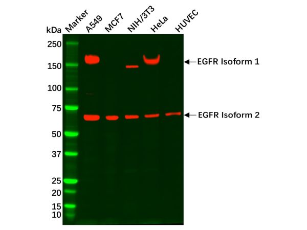 aladdin 阿拉丁 Ab101163 EGFR Mouse mAb mAb(C4); Mouse anti Human EGFR Antibody; WB, IHC; Unconjugated