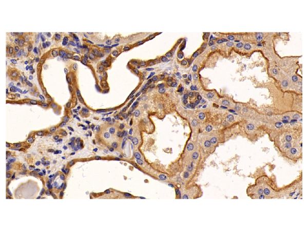 aladdin 阿拉丁 Ab101163 EGFR Mouse mAb mAb(C4); Mouse anti Human EGFR Antibody; WB, IHC; Unconjugated
