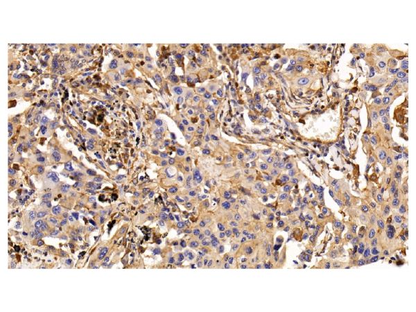 aladdin 阿拉丁 Ab101163 EGFR Mouse mAb mAb(C4); Mouse anti Human EGFR Antibody; WB, IHC; Unconjugated