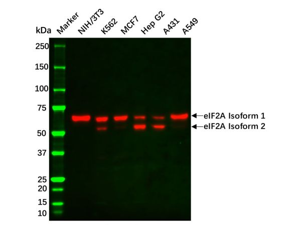 aladdin 阿拉丁 Ab101265 Recombinant eIF2A Antibody Recombinant (R08-8E2); Rabbit anti Human eIF2A Antibody; WB, ICC, IF; Unconjugated