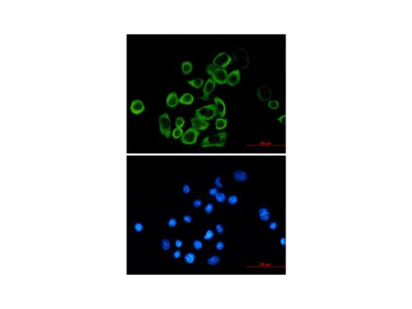 aladdin 阿拉丁 Ab101265 Recombinant eIF2A Antibody Recombinant (R08-8E2); Rabbit anti Human eIF2A Antibody; WB, ICC, IF; Unconjugated