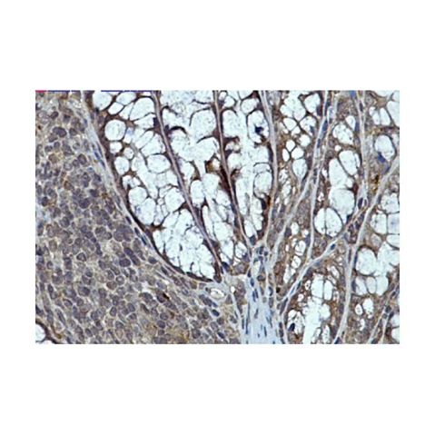 aladdin 阿拉丁 Ab101380 Recombinant eIF4E Antibody Recombinant (R04-4H7); Rabbit anti Human eIF4E Antibody; WB, IHC; Unconjugated