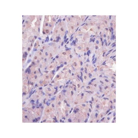aladdin 阿拉丁 Ab101387 EIF4E2 Antibody pAb; Rabbit anti Human EIF4E2 Antibody; WB, IHC; Unconjugated