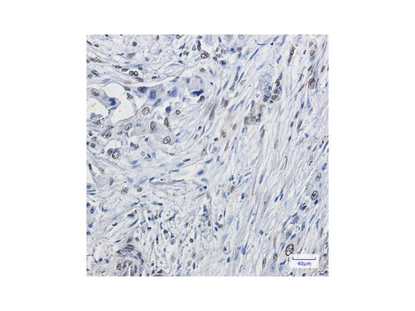 aladdin 阿拉丁 Ab101502 Recombinant ELK1 Antibody Recombinant (R06-5J2); Rabbit anti Human ELK1 Antibody; WB, IHC; Unconjugated