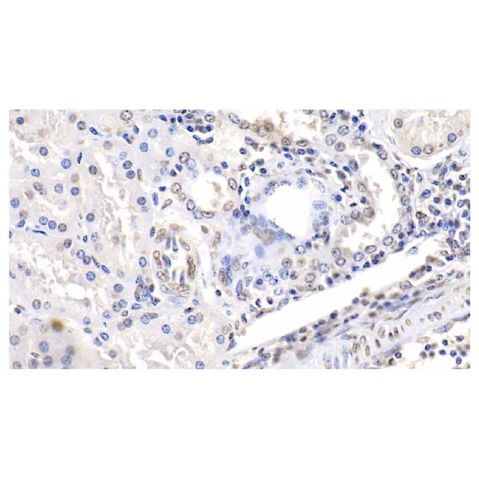 aladdin 阿拉丁 Ab101688 ENO1 Mouse mAb mAb (C2); Mouse anti Human ENO1 Antibody; WB, IHC; Unconjugated