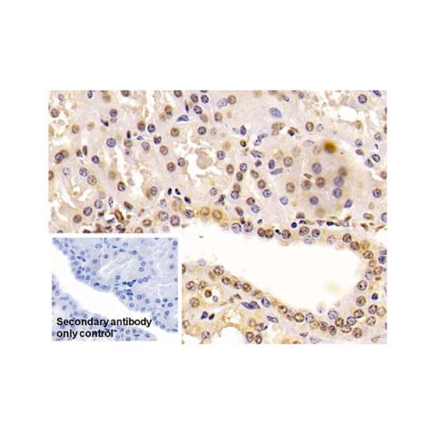 aladdin 阿拉丁 Ab101688 ENO1 Mouse mAb mAb (C2); Mouse anti Human ENO1 Antibody; WB, IHC; Unconjugated