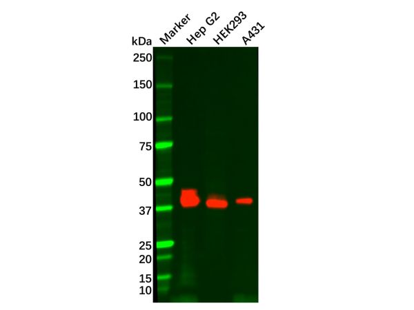 aladdin 阿拉丁 Ab101839 Recombinant EpCAM Antibody Recombinant (RR694); Rabbit anti Human EpCAM Antibody; WB, IHC, Flow, IP; Unconjugated