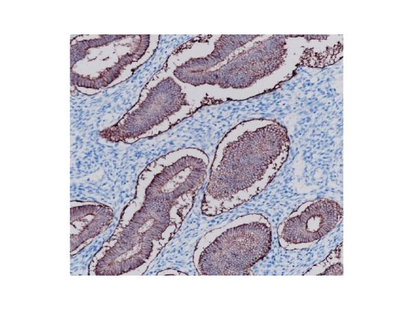 aladdin 阿拉丁 Ab101839 Recombinant EpCAM Antibody Recombinant (RR694); Rabbit anti Human EpCAM Antibody; WB, IHC, Flow, IP; Unconjugated