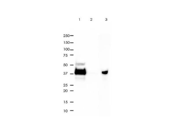 aladdin 阿拉丁 Ab101839 Recombinant EpCAM Antibody Recombinant (RR694); Rabbit anti Human EpCAM Antibody; WB, IHC, Flow, IP; Unconjugated