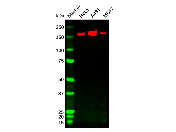 aladdin 阿拉丁 Ab102061 ErbB2/Her2 Mouse mAb mAb(1C4-1H3-1H3); Mouse anti Human ErbB2 Antibody; WB, IHC; Unconjugated