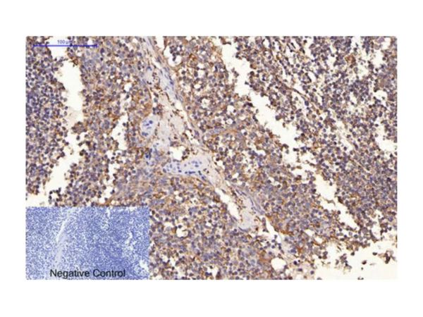 aladdin 阿拉丁 Ab102061 ErbB2/Her2 Mouse mAb mAb(1C4-1H3-1H3); Mouse anti Human ErbB2 Antibody; WB, IHC; Unconjugated
