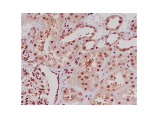 aladdin 阿拉丁 Ab102175 Recombinant ERG Antibody Recombinant (R09-9J7); Rabbit anti Human ERG Antibody; WB, IHC; Unconjugated