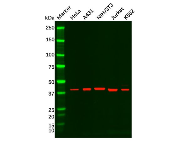 aladdin 阿拉丁 Ab102223 Recombinant ERK1 Antibody Recombinant (RR671); Rabbit anti Human ERK1 Antibody; WB, IHC, Flow, IF/ICC, IP; Unconjugated