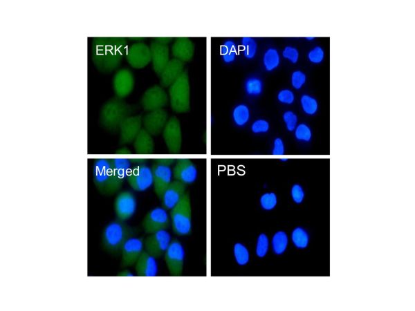 aladdin 阿拉丁 Ab102223 Recombinant ERK1 Antibody Recombinant (RR671); Rabbit anti Human ERK1 Antibody; WB, IHC, Flow, IF/ICC, IP; Unconjugated