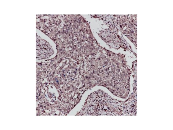 aladdin 阿拉丁 Ab102223 Recombinant ERK1 Antibody Recombinant (RR671); Rabbit anti Human ERK1 Antibody; WB, IHC, Flow, IF/ICC, IP; Unconjugated