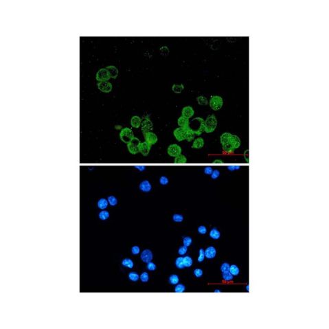 aladdin 阿拉丁 Ab102356 Recombinant Estrogen Receptor alpha Antibody Recombinant (R05-1E4); Rabbit anti Human Estrogen Receptor alpha Antibody; WB, IHC, ICC, IF; Unconjugated