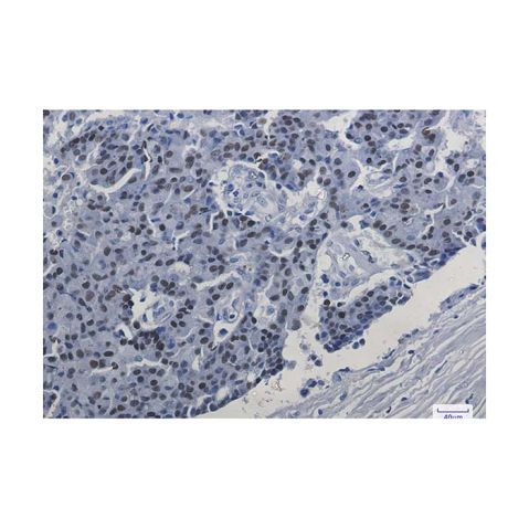 aladdin 阿拉丁 Ab102356 Recombinant Estrogen Receptor alpha Antibody Recombinant (R05-1E4); Rabbit anti Human Estrogen Receptor alpha Antibody; WB, IHC, ICC, IF; Unconjugated