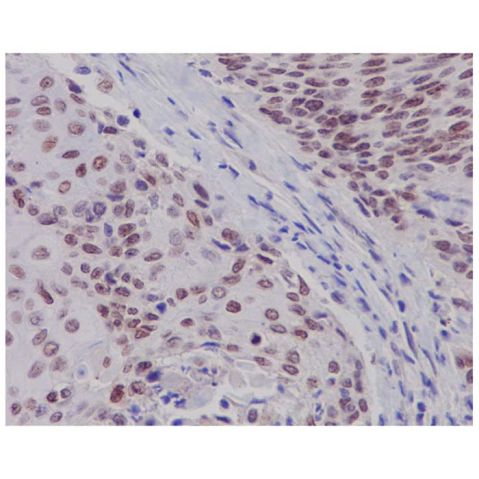 aladdin 阿拉丁 Ab102374 Estrogen Receptor beta Antibody pAb; Rabbit anti Human Estrogen Receptor beta Antibody; WB, IHC; Unconjugated