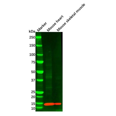 aladdin 阿拉丁 Ab102606 FABP4 Mouse mAb mAb (C12); Mouse anti Human FABP4 Antibody; WB, IHC; Unconjugated