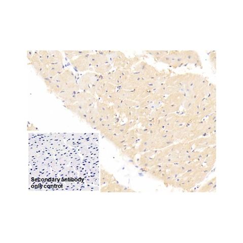 aladdin 阿拉丁 Ab102606 FABP4 Mouse mAb mAb (C12); Mouse anti Human FABP4 Antibody; WB, IHC; Unconjugated