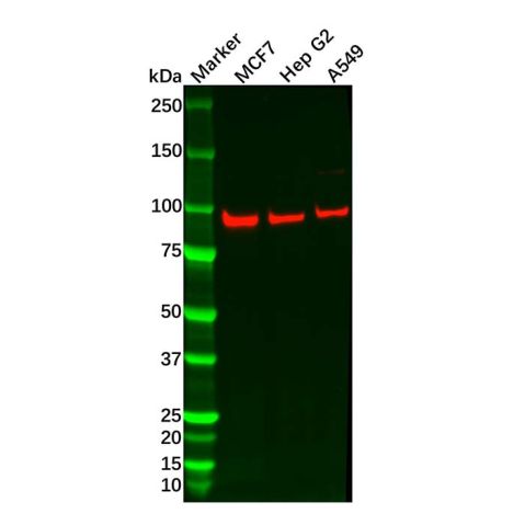 aladdin 阿拉丁 Ab103180 FER Mouse mAb mAb (1457CT181.12.17); Mouse anti Human FER Antibody; WB, IHC; Unconjugated 