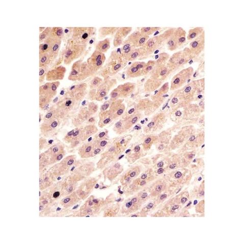 aladdin 阿拉丁 Ab103180 FER Mouse mAb mAb (1457CT181.12.17); Mouse anti Human FER Antibody; WB, IHC; Unconjugated 