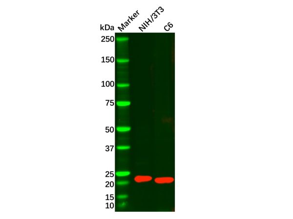 aladdin 阿拉丁 Ab103206 Ferritin Light Chain Mouse mAb mAb (H1); Mouse anti Human Ferritin Light Chain Antibody; WB, IHC; Unconjugated
