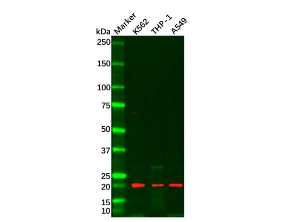aladdin 阿拉丁 Ab103206 Ferritin Light Chain Mouse mAb mAb (H1); Mouse anti Human Ferritin Light Chain Antibody; WB, IHC; Unconjugated