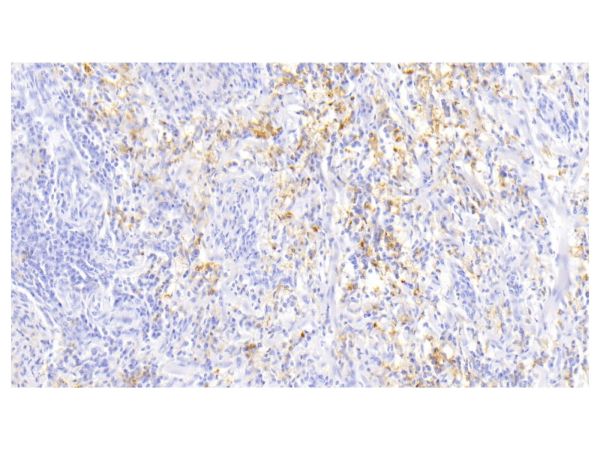 aladdin 阿拉丁 Ab103206 Ferritin Light Chain Mouse mAb mAb (H1); Mouse anti Human Ferritin Light Chain Antibody; WB, IHC; Unconjugated