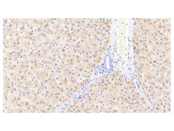 aladdin 阿拉丁 Ab103206 Ferritin Light Chain Mouse mAb mAb (H1); Mouse anti Human Ferritin Light Chain Antibody; WB, IHC; Unconjugated