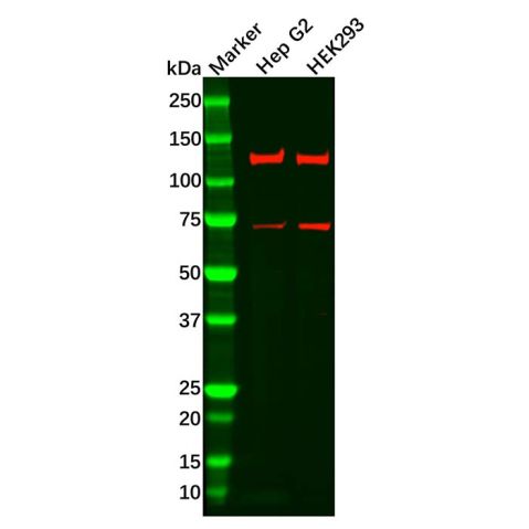 aladdin 阿拉丁 Ab103377 Recombinant FGFR3 Antibody Recombinant (R06-6F4); Rabbit anti Human FGFR3 Antibody; WB, IHC, ICC, IF; Unconjugated