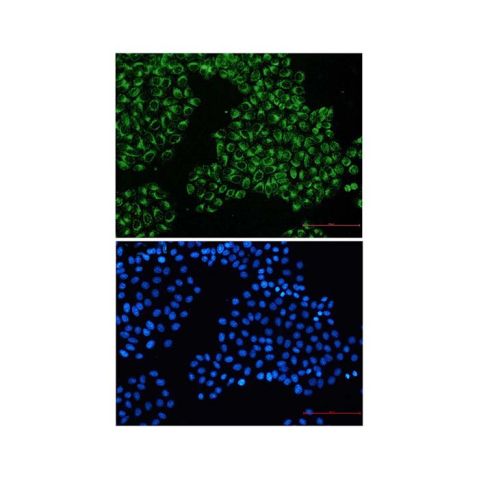 aladdin 阿拉丁 Ab103377 Recombinant FGFR3 Antibody Recombinant (R06-6F4); Rabbit anti Human FGFR3 Antibody; WB, IHC, ICC, IF; Unconjugated