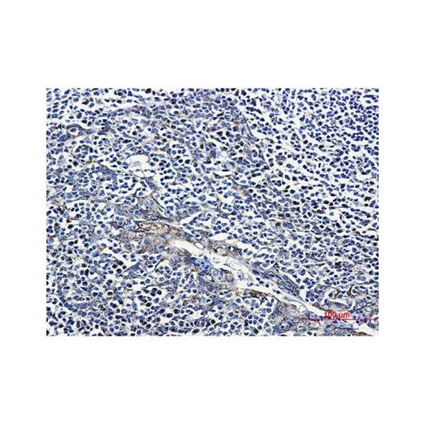 aladdin 阿拉丁 Ab103377 Recombinant FGFR3 Antibody Recombinant (R06-6F4); Rabbit anti Human FGFR3 Antibody; WB, IHC, ICC, IF; Unconjugated